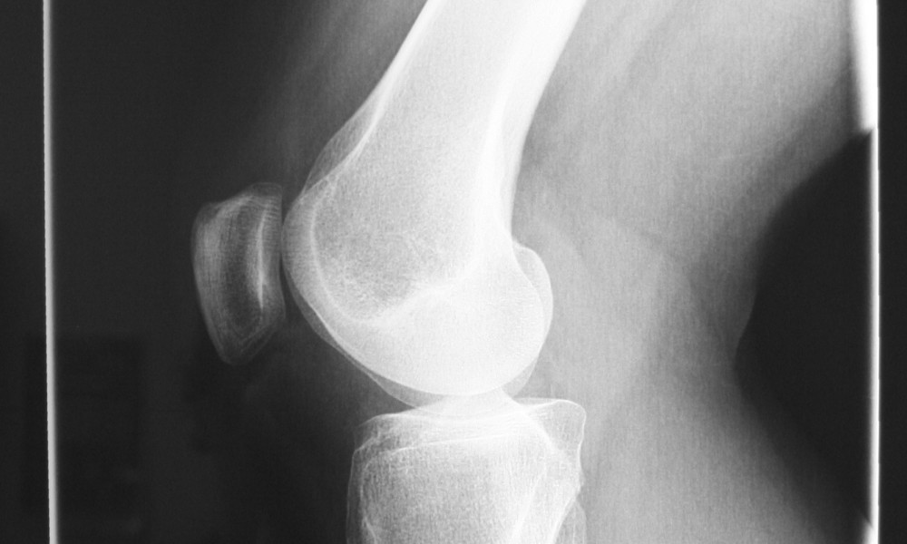 Rehabilitacja to dyscyplina medycyny, jaka niezwykle ekspresowo się otwiera